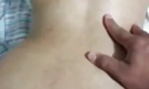in anal prolapse mus ...