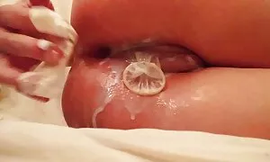 anal dafalen ni sper ...